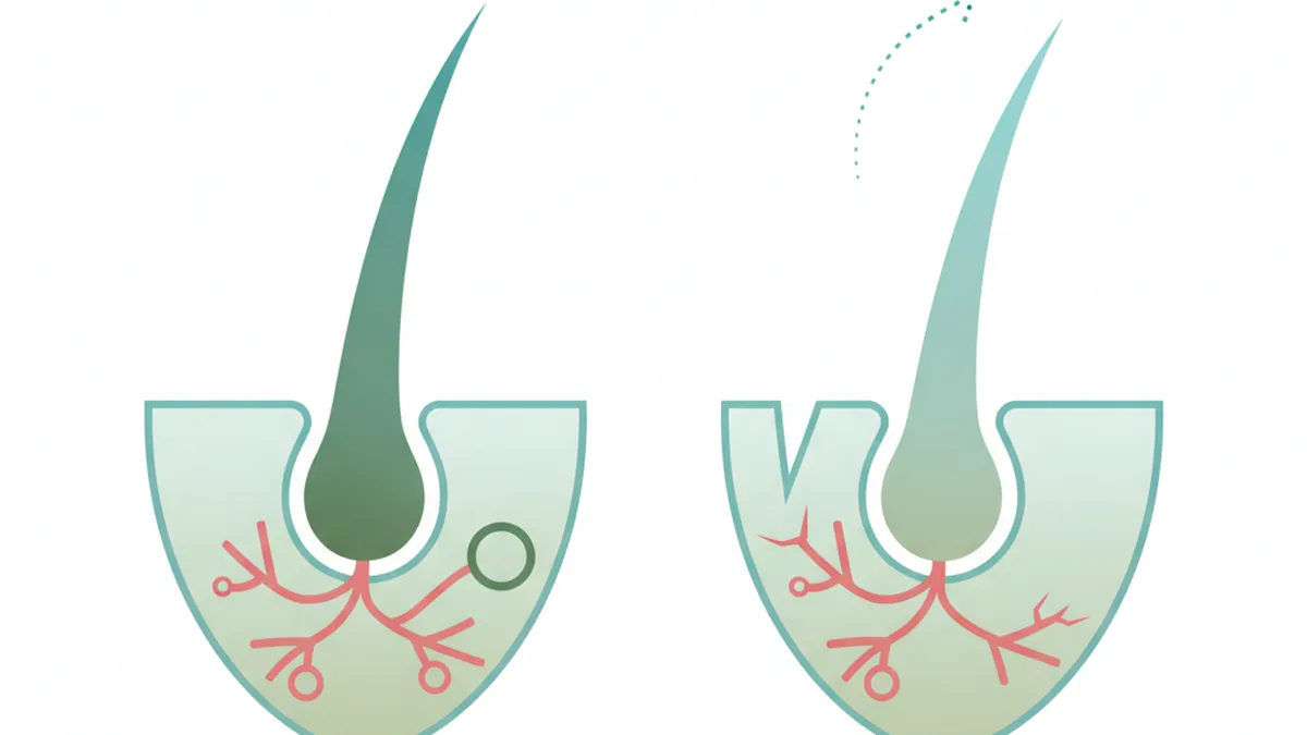 Illustration: Is this temporary or am I actually going bald?