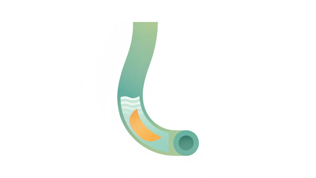 Illustration: Occasional Reflux: The Body's Temporary Glitch